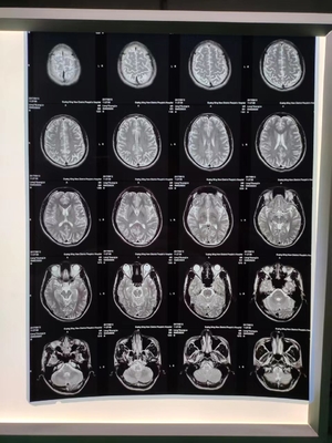 210 Microns van Inkjet X Ray Film A3