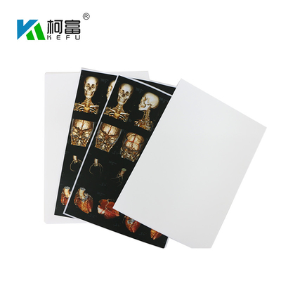 Blauwe Witte Basis Medisch X Ray Film 35x43CM 10x12-Duim X Ray Dry Film For Fuji-Printer