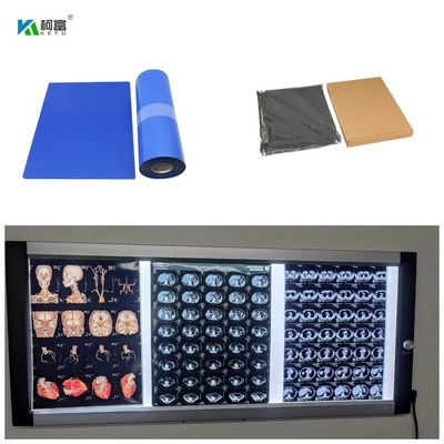 Blauwe Basis Droog Inkjet Medisch X Ray Films DR. CT MRI de Bladen van de Kleurstofinkt 8x10 A4 A3 100