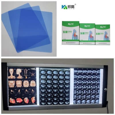 Output 280gsm Medisch X Ray Film Inkjet Blue Base voor DR. CT MRI Beeld 10x12 11x14 A4 A3
