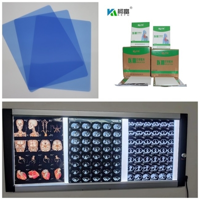 150 micron Inkjet X-Ray Film Printing Speed 1-3 minuten Voor medische 10 inch