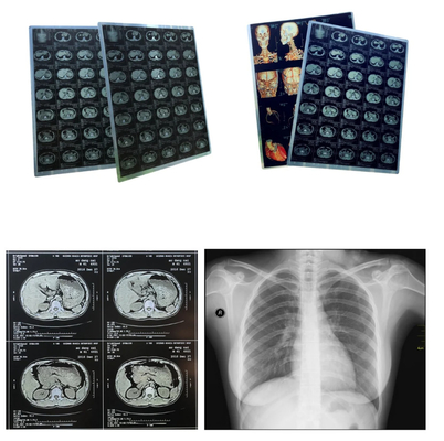 Blauwe X-ray film medische inkjet droge film Clear Image