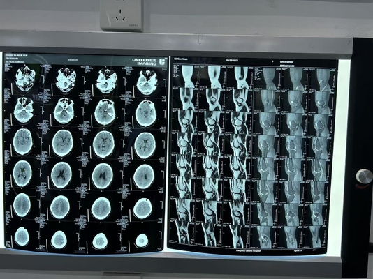 Dichtheidverbeterde diagnostische laserröntgenfilm 0.28D voor medische apparatuur