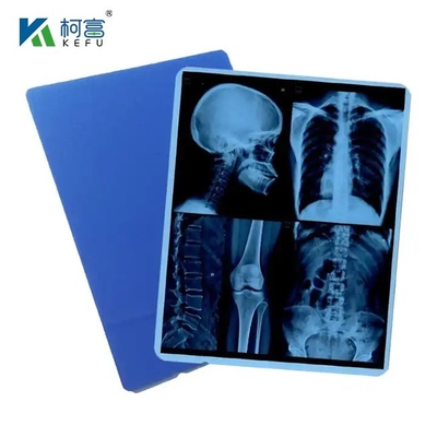 Medische blauwe inkjet gebaseerde droge beeldvorming X-ray film huisdier Blauwe basisfilm voor het maken van X-ray film Epson HP printers