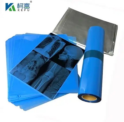 Blauwe PET-gebaseerde thermische/inkjetfilm voor medische afbeeldingen voor klinieken en ziekenhuizen