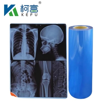 Waterdichte medische thermische X-ray film X-ray blauwe film voor inkjetprinters