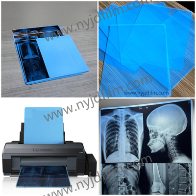 210 Microns de Blauwe van X Ray Film Medical Inkjet Printing Film voor het Ziekenhuis