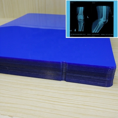 ISO9001 blauwe Inkjet-de Drukfilm 11*14In van Film Medische Inkjet