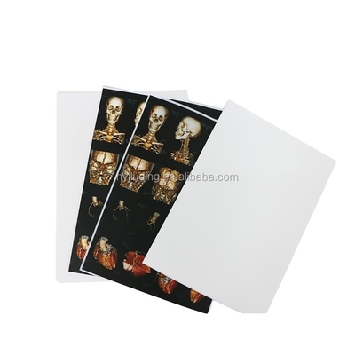 Wit Basishuisdier Inkjet X Ray Film 150 Inkjet-van de Drukmicrons Film