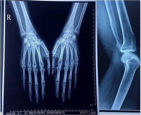 14x17 Laser X-ray Film FUJI DI-HL 14x17&quot; 35x43cm Medische Laser Film Fuji Droog Film