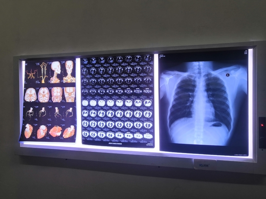 210mmx297mm Waterdichte Laser X Ray Film 150 Microns van OKI Xerox Fuji de PrinterFilm