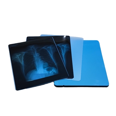 203mm X 254mm Medische Thermische Film Droog X Ray Film For Fuji Drypix 3500 de Printer van 2000
