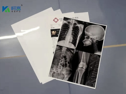 13X17“ Witte 180 Microns HUISDIEREN X Ray Film Sheets Transparency Film voor Inkjet-Printers