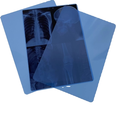 OEM Radiologiehuisdier X de Duimtoner van Ray Film 11x14 de Medische Blauwe Film van de Laserdruk