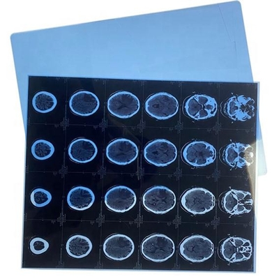 13x17 duim Droog Blauw X Ray Medical Film Blue Transparency Document voor Laserprinter