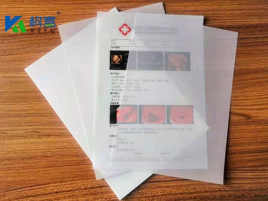 Geprinte laser-röntgenfilm Uitstekende UV-bestandheid En goede vochtbestandheid