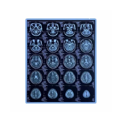 Van het de Duimhuisdier van Ce de Voor het drukken geschikte Blauwe Medische X Ray Film 11x14 Film van Inkjet