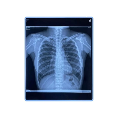 Van het de Duimhuisdier van Ce de Voor het drukken geschikte Blauwe Medische X Ray Film 11x14 Film van Inkjet