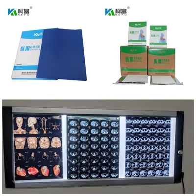 DR. CT MRI de Medische Inkjet Droge X Ray Films 280gsm Bladen van de Kleurstofinkt 8x10 13x17 A4 A3