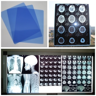 210um Inkjet Medisch X Ray Film Blue For Digital DR. CT MRI Cassette met Bladen 8x10