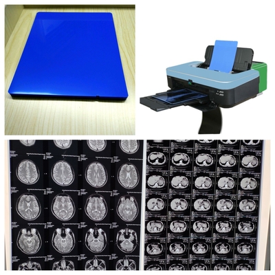 Glanzende Inkjet X-Ray Film Blauw Wit Met 9600x2400dpi Resolutie Langdurige Duurzaamheid