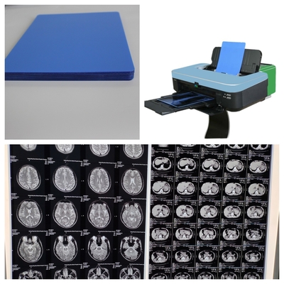 150 micron Inkjet X-Ray Film Printing Speed 1-3 minuten Voor medische 10 inch