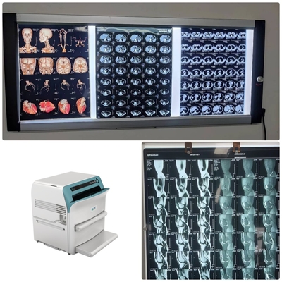 Klasse I de Medische van het de Duimziekenhuis van X Ray Film Radiology 14*17 Blauwe Thermische Film