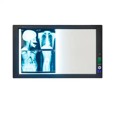 Blauwe medische röntgenfilm voor inkjetprinters met hoge scherpte en weinig mist
