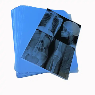 Blauwe op PET gebaseerde thermische inkjet-röntgenfilm medische afbeeldingen voor ziekenhuizen