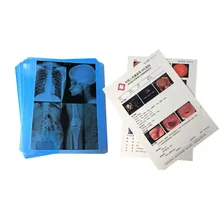 Compatibiliteit Canon / Epson Inkjet Printers Inkjet X Ray Film 210 micron Blauwe filmdikte