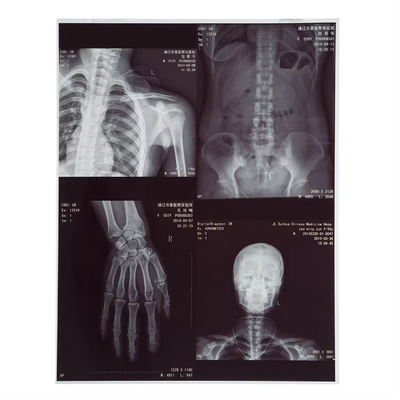 210 micron X-Ray Film Medische Inkjet Laser Voor CT Dr Mr