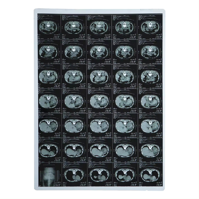 210 micron X-Ray Film Medische Inkjet Laser Voor CT Dr Mr