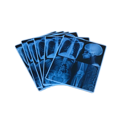 Hoge beeldstabiliteit Blauwe medische film Inkjet voor inkjet X-ray film