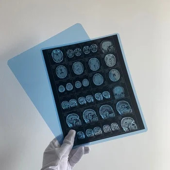 Medische röntgendroge film medische röntgen inkjetfilm met heldere beeldkwaliteit