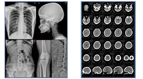 Blauwe X-ray film medische inkjet droge film Clear Image