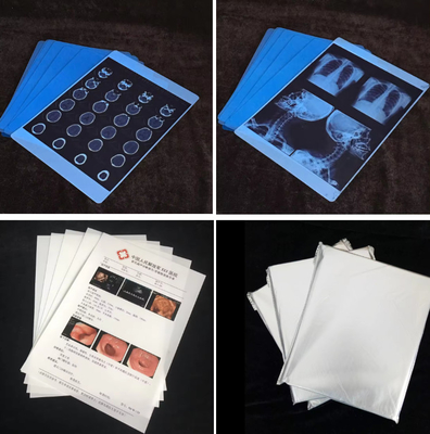 Professionele Epson waterdichte inkjetprinter X-ray film voor het afdrukken van op water gebaseerde kleurstoffen / pigmenten