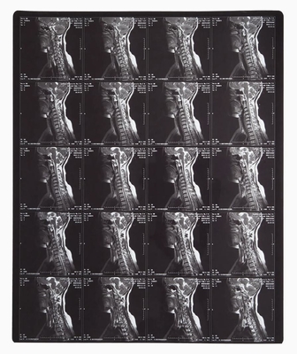 Blauwe laserfilm voor radiologische beeldvorming voor thermische printer