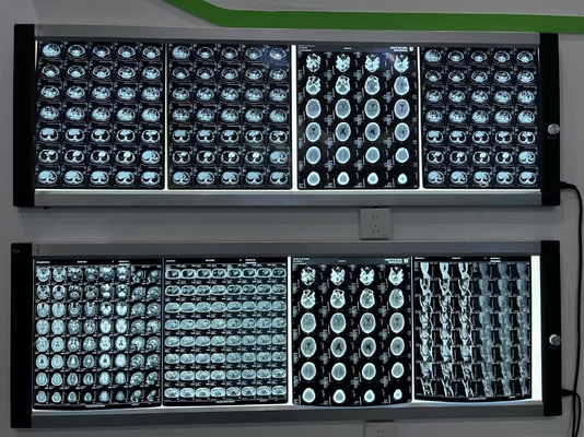 Precision Laser X Ray Film Blauw Thermisch Printen Goed vochtbestendig voor digitale beeldvorming