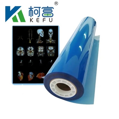 Fabriek Medische röntgenfilm Blauw Gevoelige Medische röntgenfilm