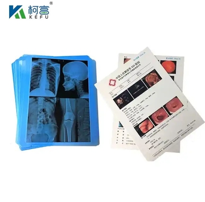 CT Scanner Droge Röntgenfilm 24x30 inch Inkjet Groen Blauwe basis Medische Röntgenfilm