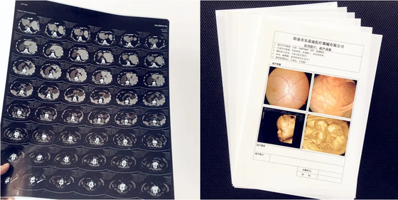 Medische benodigdheden Laser Print Film Wit Opaque Medische Röntgenfilm Afbeeldingsdrukfilm Voor Epson &amp; Canon Inkjet Printer