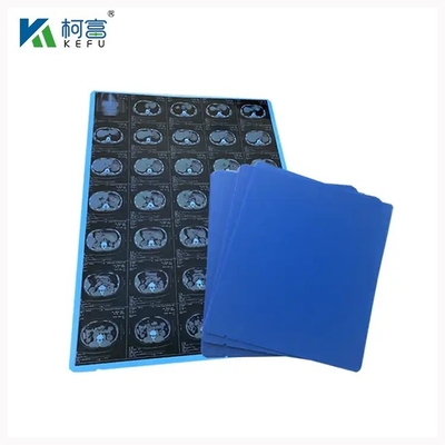 Radiologie PET Dry Inkjet Blauwe Medische Film 8x10 10x12 11x14 14x17 Inch Medische Orthopedische Röntgenfilms
