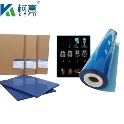 Gepersonaliseerde grootte 35x43 Inkjet Blauwe Medische Röntgenfilm Voor Epson A4 PET Droge Blauwe Medische Laser Röntgen