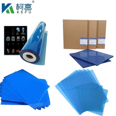 Gepersonaliseerde grootte Blauwe PET-gebaseerde röntgen-inkjet/laserfilm medische afbeeldingen voor klinieken en ziekenhuizen