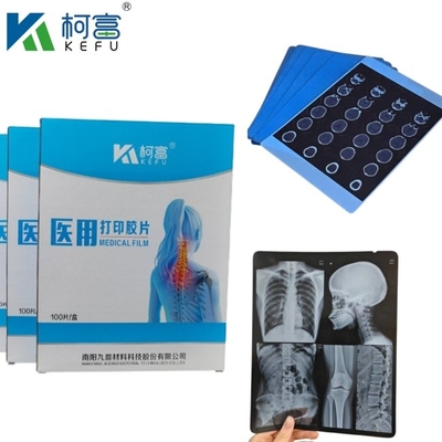Gepersonaliseerde grootte Blauwe PET-gebaseerde röntgen-inkjet/laserfilm medische afbeeldingen voor klinieken en ziekenhuizen