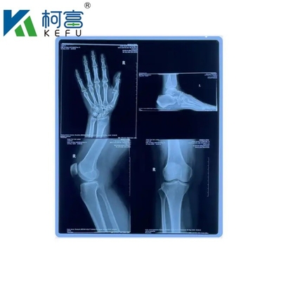 Gepersonaliseerde grootte Blauwe PET-gebaseerde röntgen-inkjet/laserfilm medische afbeeldingen voor klinieken en ziekenhuizen