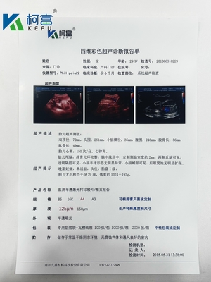Inkjet transparante medische droge film witte röntgenfilm voor CT DR MRI radiologisch apparaat