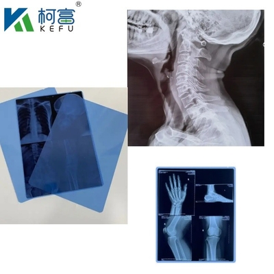 Medische röntgenfilm droog blauw inkjetfilm CT DR film A4 8x10 plaat of rol voor medische inkjetprinters