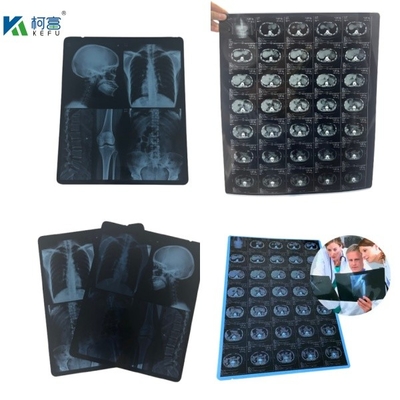 Inkjetprinten X-Ray Medische droge inkjet X-ray imaging film voor medische apparaten