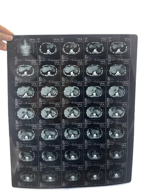 Inkjetprinten X-Ray Medische droge inkjet X-ray imaging film voor medische apparaten